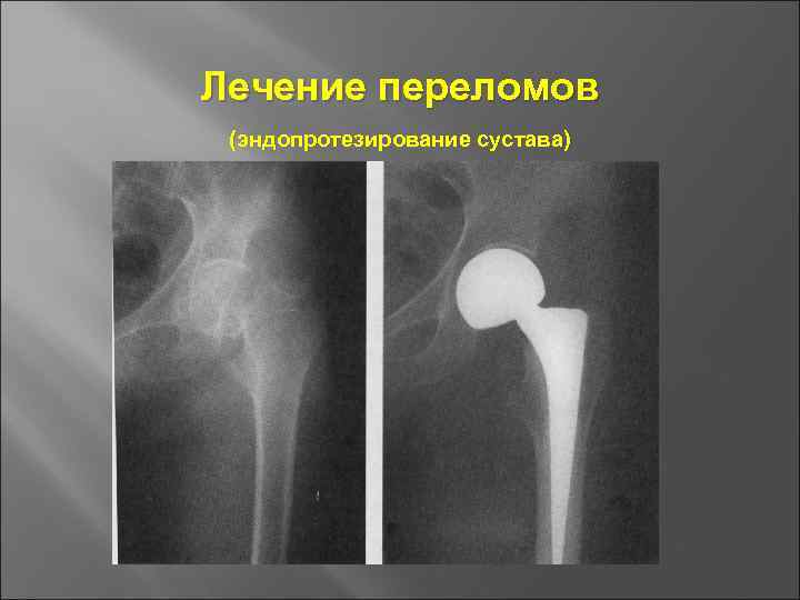 Основы травматологии презентация