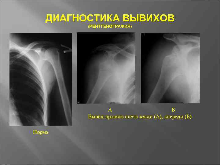 Основы травматологии презентация