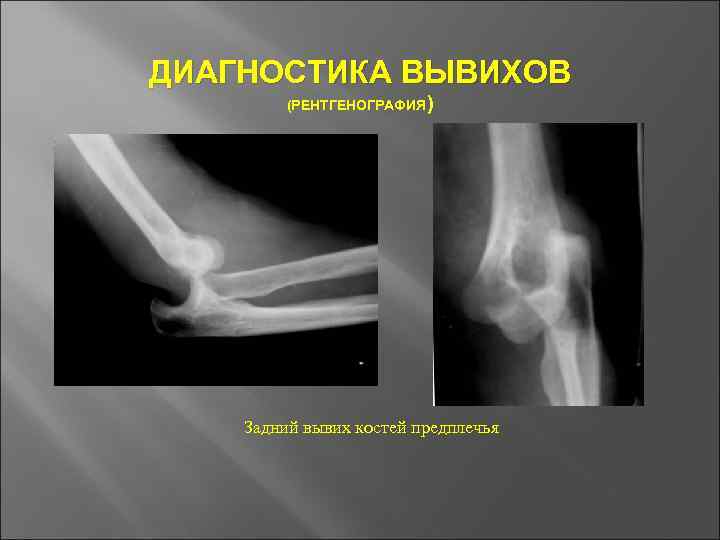 Основы травматологии презентация