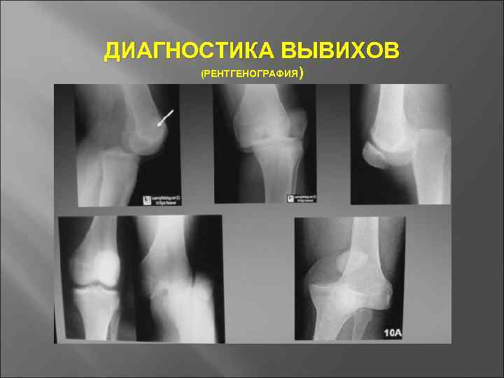 Основы травматологии презентация