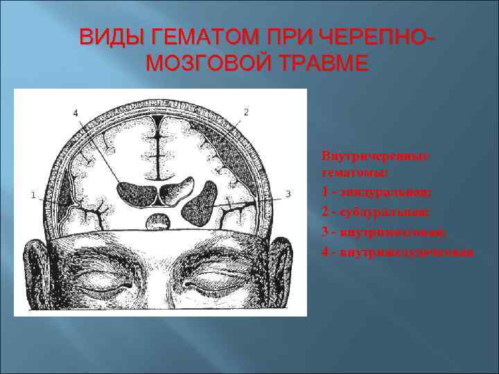 Травма головы черепно мозговая травма. Черепно мозговая гематома. Формы повреждения головного мозга при ЧМТ. Гематомы головы классификация.