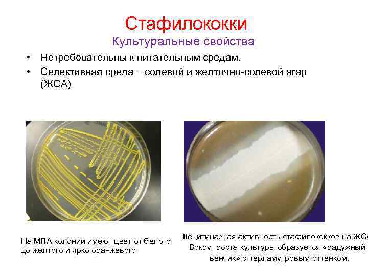  Стафилококки Культуральные свойства • Нетребовательны к питательным средам. • Селективная среда – солевой