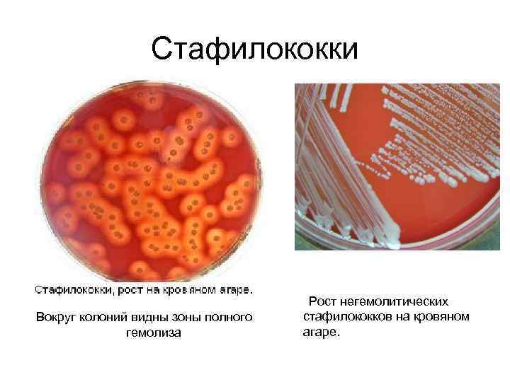 Стафилококки Вокруг колоний видны зоны полного гемолиза Рост негемолитических стафилококков на кровяном агаре. 