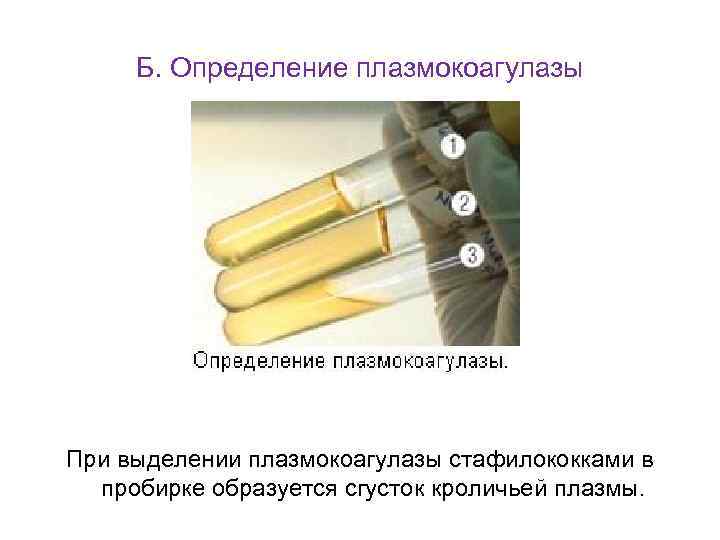 Б. Определение плазмокоагулазы При выделении плазмокоагулазы стафилококками в пробирке образуется сгусток кроличьей плазмы. 