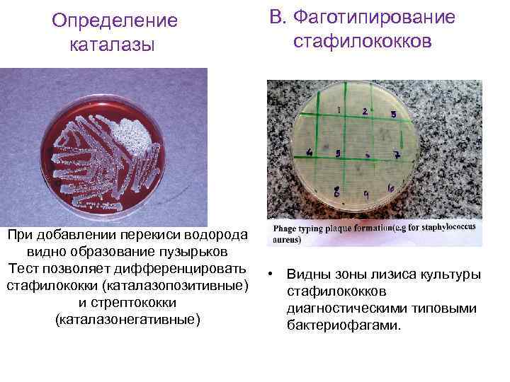  Определение каталазы При добавлении перекиси водорода видно образование пузырьков Тест позволяет дифференцировать стафилококки