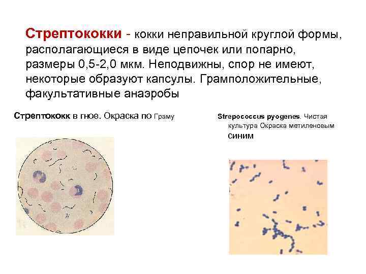 Стрептококки - кокки неправильной круглой формы, располагающиеся в виде цепочек или попарно, размеры 0,