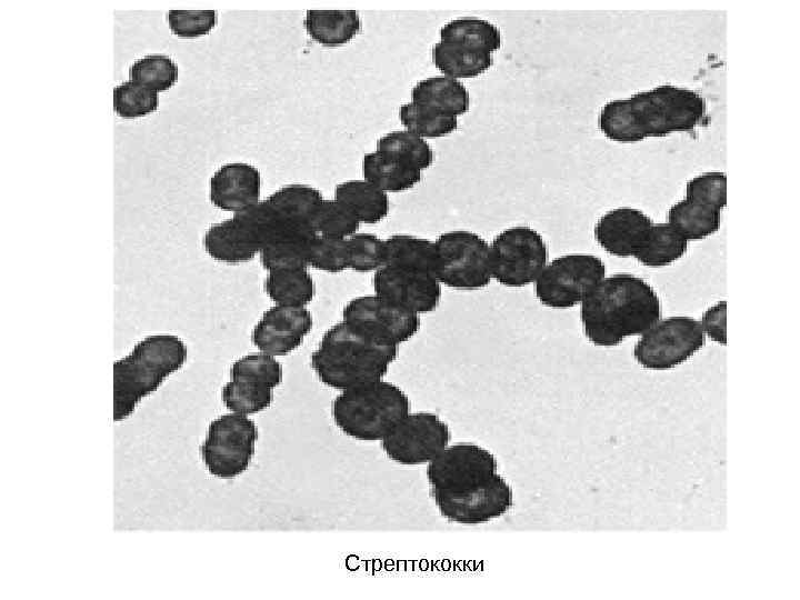 Стрептококки 