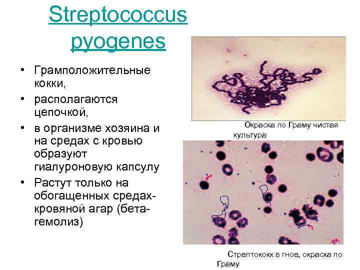 Стрептококки у женщин лечение. Патогенные кокки. Грамположительные кокки. Стрептококк пиогенес морфологические свойства. Морфологические свойства Streptococcus pyogenes. Грамположительные стрептококки.