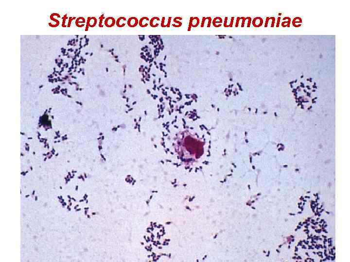 Streptococcus pneumoniae 