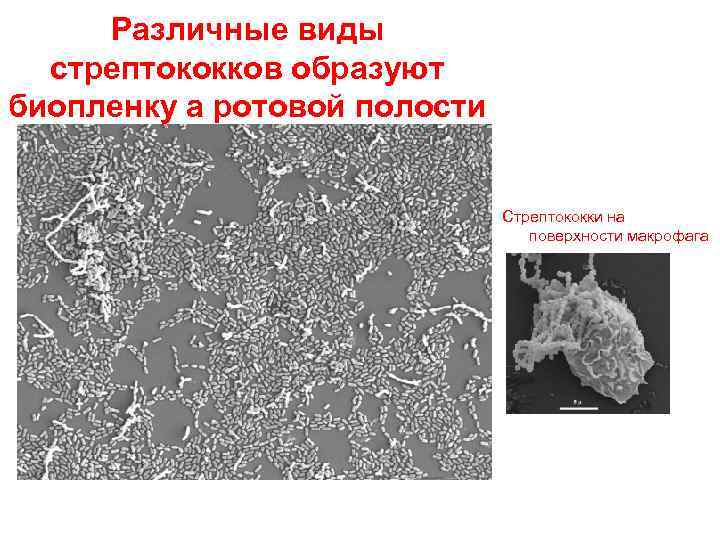 Различные виды стрептококков образуют биопленку а ротовой полости Стрептококки на поверхности макрофага 