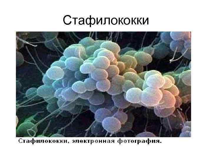 Стафилококки 