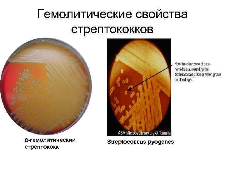 Гемолитические свойства стрептококков ά-гемолитический стрептококк Streptococcus pyogenes 