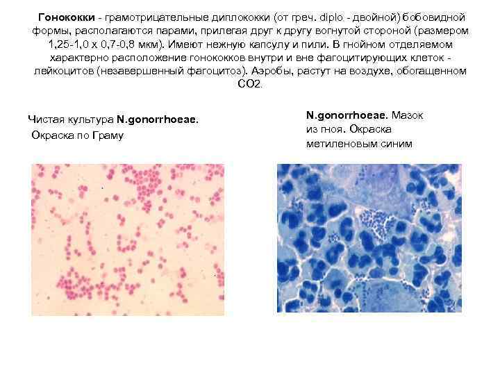  Гонококки - грамотрицательные диплококки (от греч. diplo - двойной) бобовидной формы, располагаются парами,