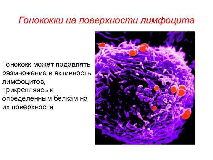 Гонококки на поверхности лимфоцита Гонококк может подавлять размножение и активность лимфоцитов, прикрепляясь к определенным