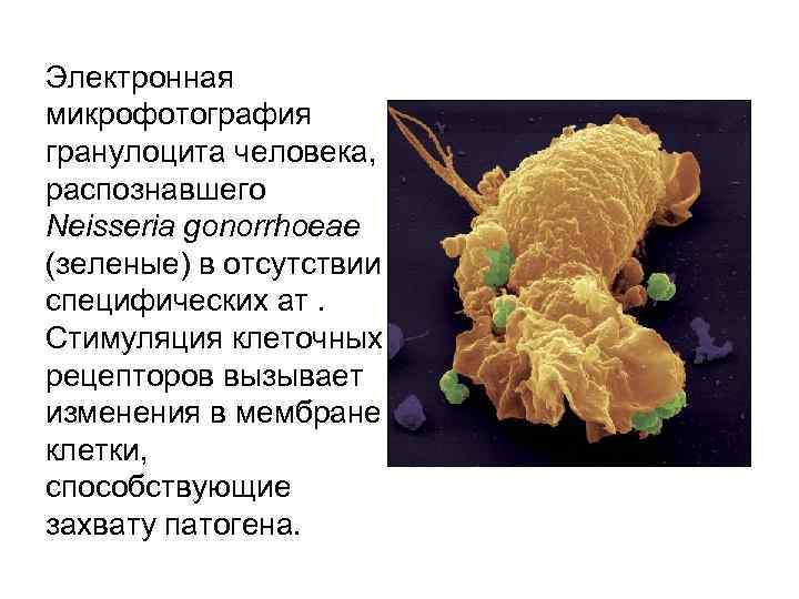 Электронная микрофотография гранулоцита человека, распознавшего Neisseria gonorrhoeae (зеленые) в отсутствии специфических ат. Стимуляция клеточных