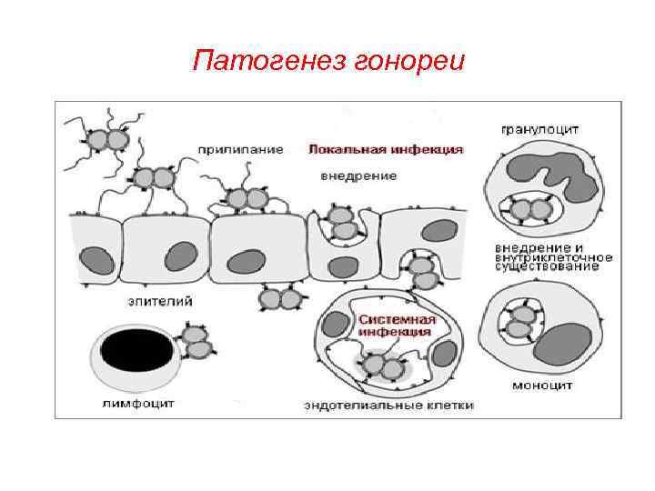 Патогенез гонореи 