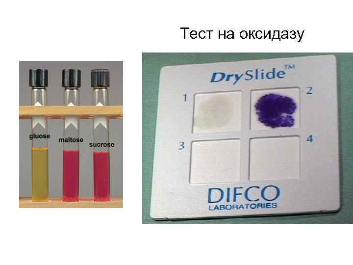 Тест на оксидазу 