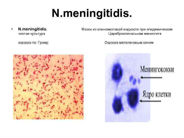 N. meningitidis. • N. meningitidis. Мазок из спиномозговой жидкости при эпидемическом чистая культура Цереброспинальном