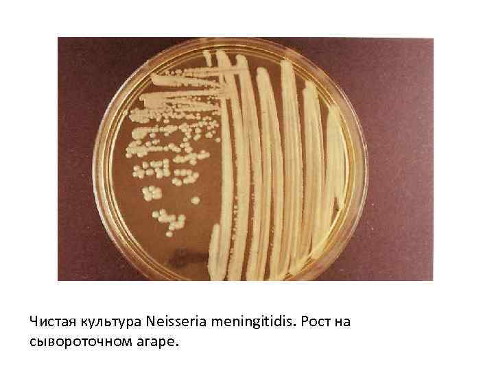 Чистая культура Neisseria meningitidis. Рост на сывороточном агаре. 