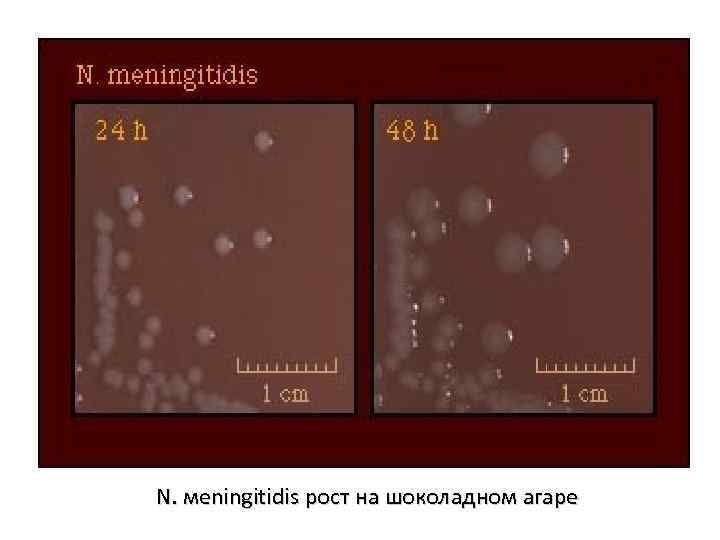 N. мeningitidis рост на шоколадном агаре 