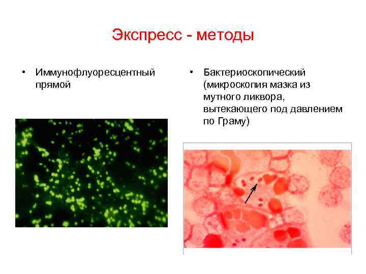 Экспресс - методы • Иммунофлуоресцентный прямой • Бактериоскопический (микроскопия мазка из мутного ликвора, вытекающего