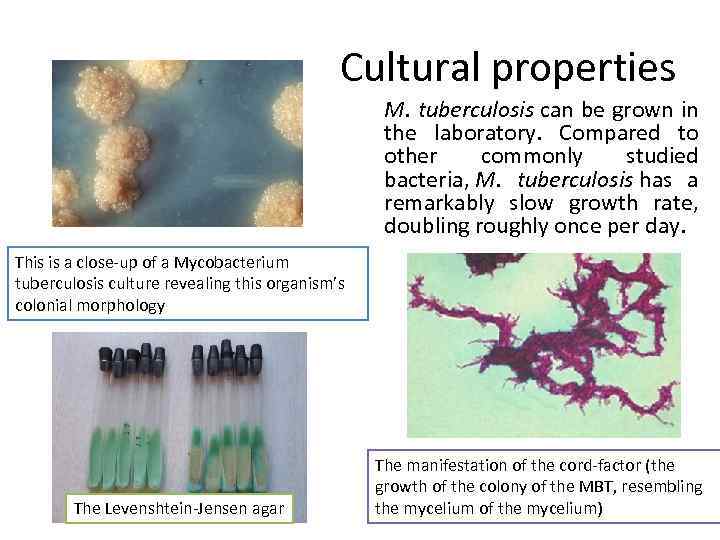 Cultural properties M. tuberculosis can be grown in the laboratory. Compared to other commonly