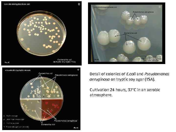 Detail of colonies of E. coli and Pseudomonas aeruginosa on tryptic soy agar (TSA).