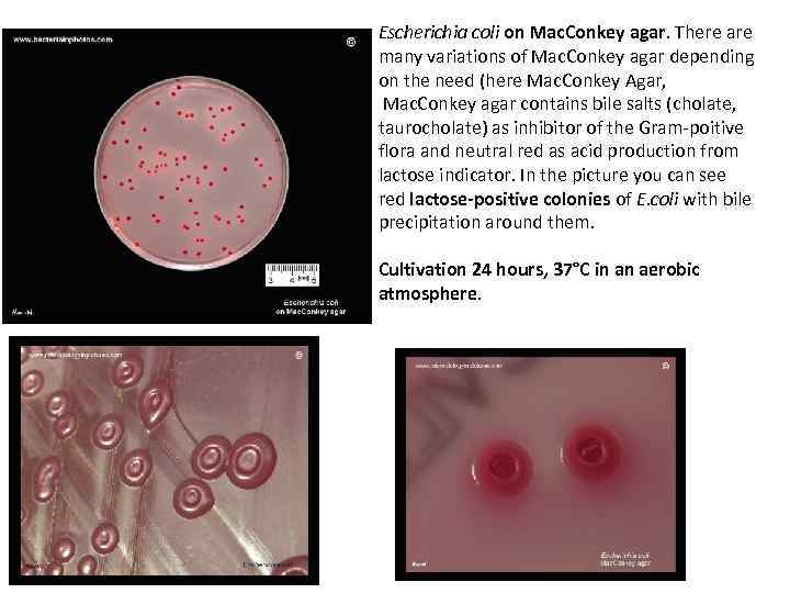 Escherichia coli on Mac. Conkey agar. There are many variations of Mac. Conkey agar