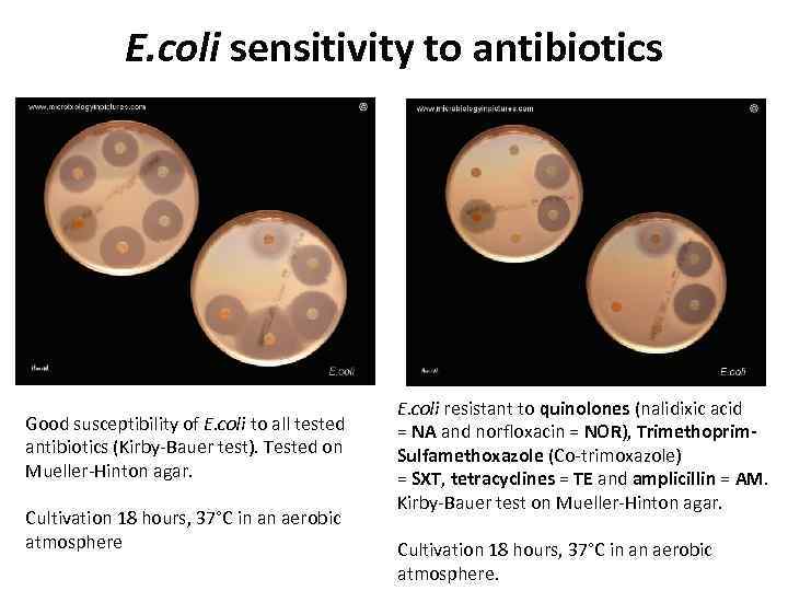 E. coli sensitivity to antibiotics Good susceptibility of E. coli to all tested antibiotics