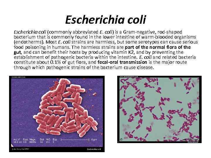 Escherichia coli (commonly abbreviated E. coli) is a Gram-negative, rod-shaped bacterium that is commonly