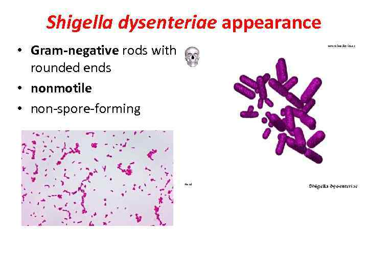 Shigella dysenteriae appearance • Gram-negative rods with rounded ends • nonmotile • non-spore-forming 