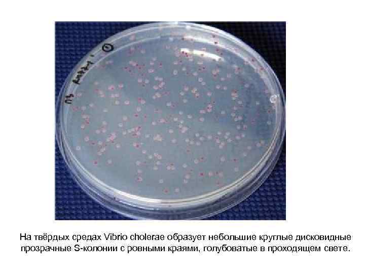 На твёрдых средах Vibrio cholerae образует небольшие круглые дисковидные прозрачные S-колонии с ровными краями,