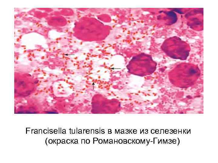 Francisella tularensis в мазке из селезенки (окраска по Романовскому-Гимзе) 