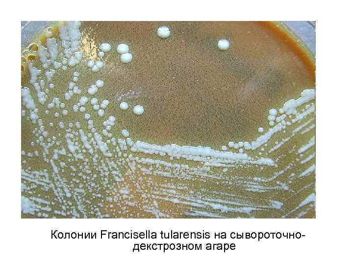 Колонии Francisella tularensis на сывороточнодекстрозном агаре 