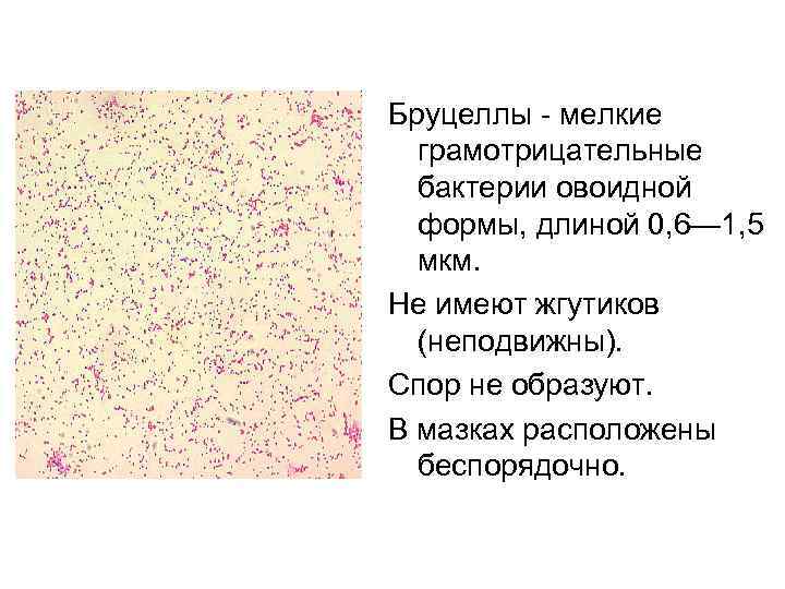 Бруцеллы - мелкие грамотрицательные бактерии овоидной формы, длиной 0, 6— 1, 5 мкм. Не