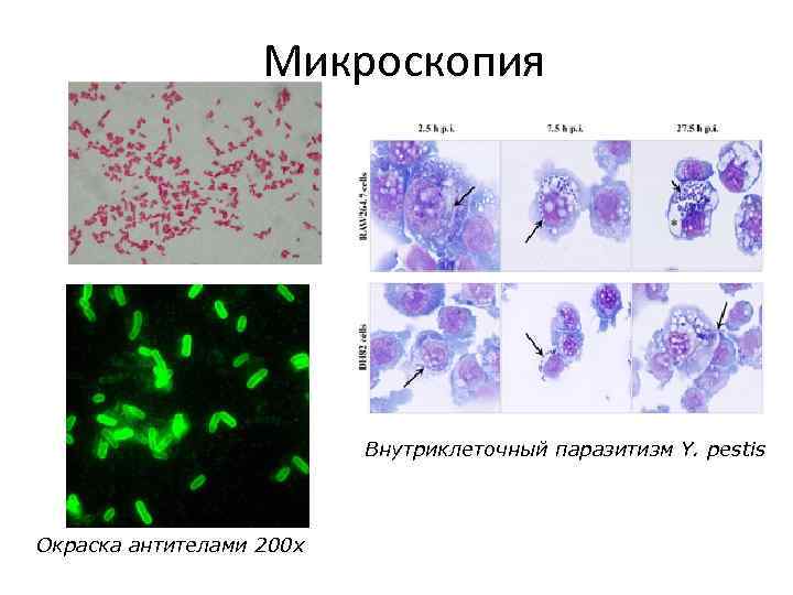 Микроскопия Внутриклеточный паразитизм Y. pestis Окраска антителами 200 x 