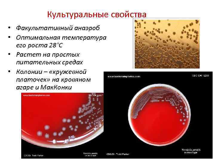 Культуральные свойства • Факультативный анаэроб • Оптимальная температура его роста 28°С • Растет на