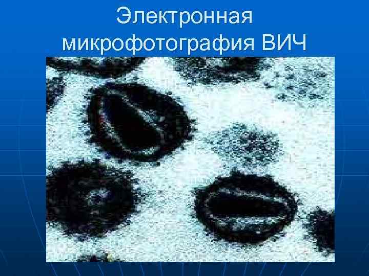 Электронная микрофотография ВИЧ 