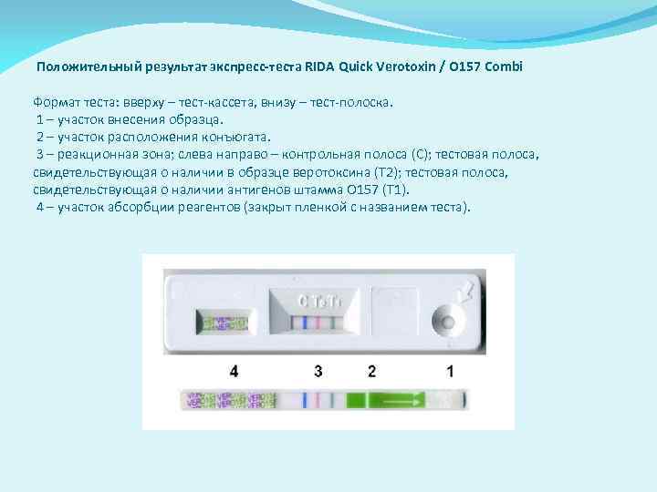 Положительный результат экспресс-теста RIDA Quick Verotoxin / О 157 Combi Формат теста: вверху –