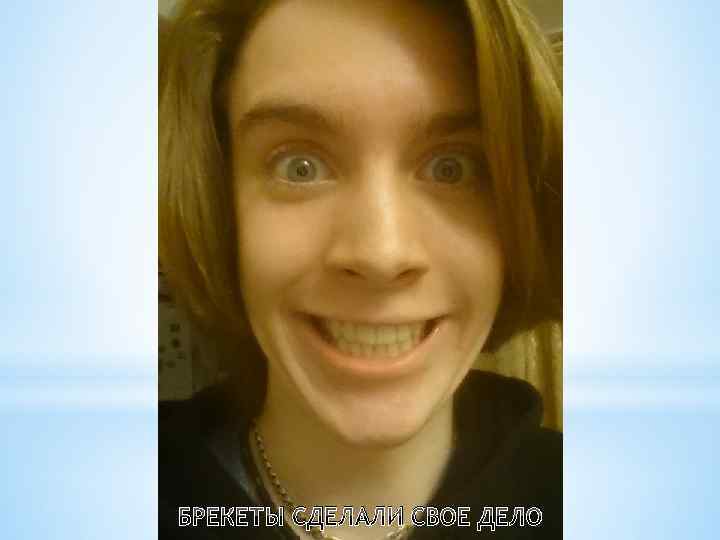 БРЕКЕТЫ СДЕЛАЛИ СВОЕ ДЕЛО 