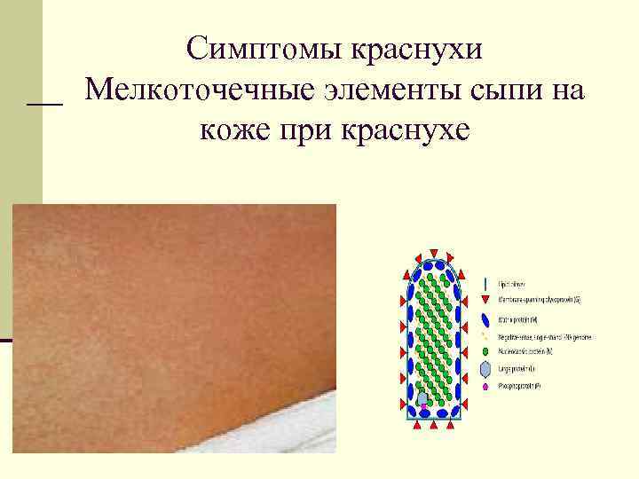Симптомы краснухи Мелкоточечные элементы сыпи на коже при краснухе 