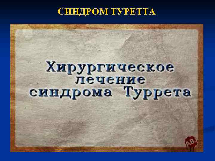 Синдром туретта лечение. Синдром Туретта. Синдром Туретта этиология. Синдром Туретта слабая форма. Синдром де ля Туретта.