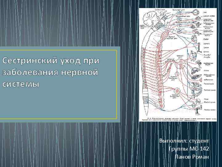 Сестринский уход при заболевания нервной системы Выполнил: студент Группы МС 142 Панов Роман 