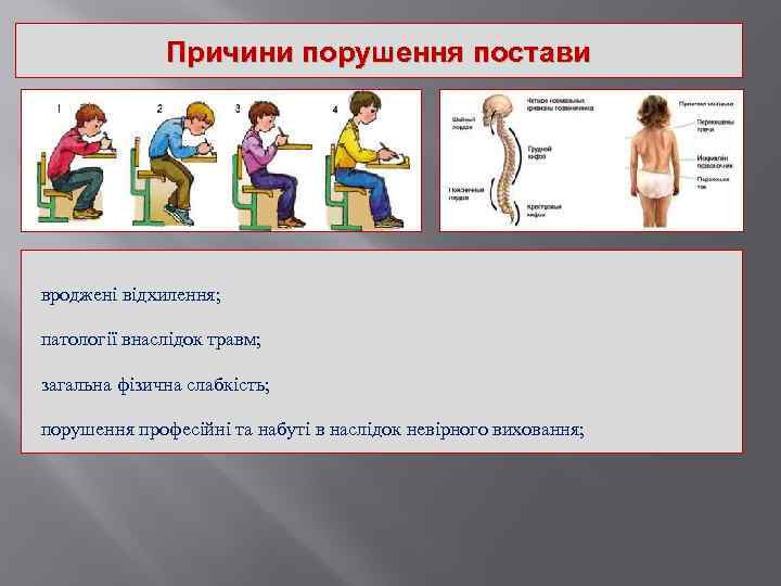 Причини порушення постави вроджені відхилення; патології внаслідок травм; загальна фізична слабкість; порушення професійні та