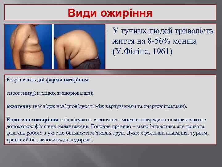 Види ожиріння У тучних людей тривалість життя на 8 -56% менша (У. Філіпс, 1961)