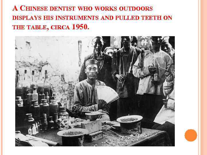 A CHINESE DENTIST WHO WORKS OUTDOORS DISPLAYS HIS INSTRUMENTS AND PULLED TEETH ON THE