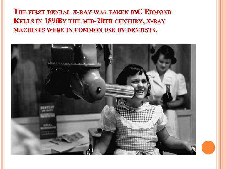 THE FIRST DENTAL X-RAY WAS TAKEN BYC EDMOND KELLS IN 1896. Y THE MID-20