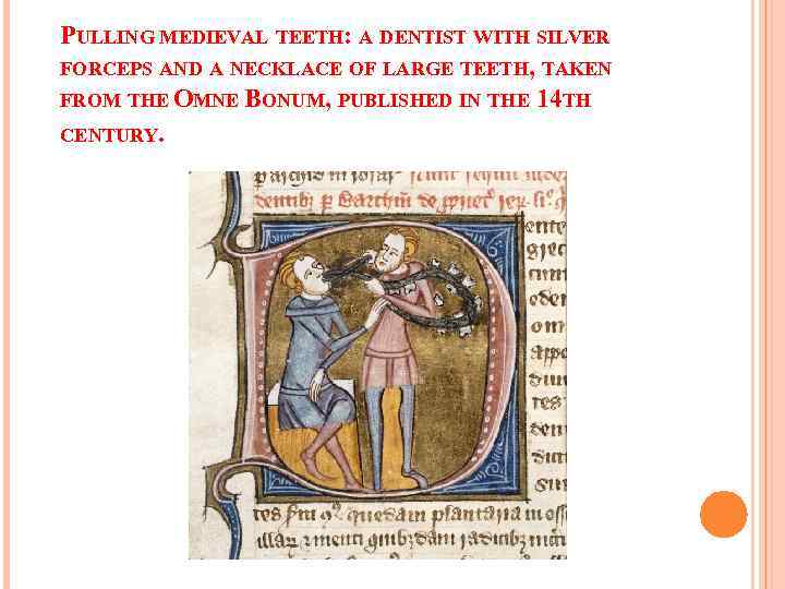 PULLING MEDIEVAL TEETH: A DENTIST WITH SILVER FORCEPS AND A NECKLACE OF LARGE TEETH,