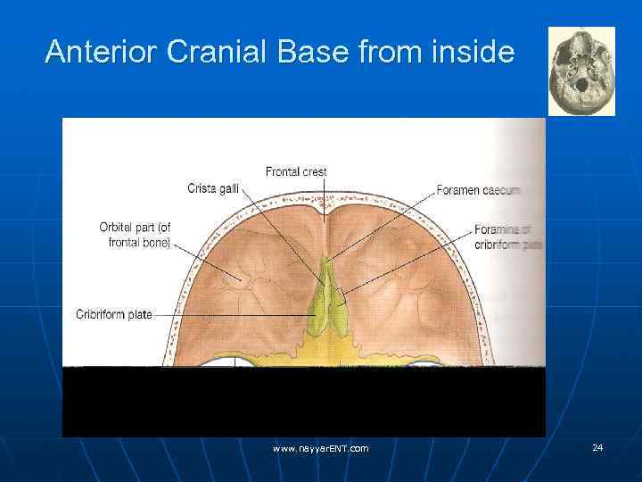 Anterior Cranial Base from inside www. nayyar. ENT. com 24 