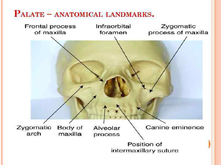 PALATE – ANATOMICAL LANDMARKS. 